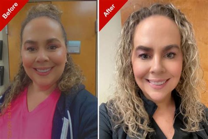 Before & After Photo – Hollywood Life
