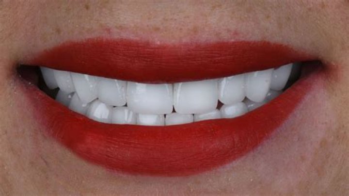 Did ‘L&HH’ Star Amina Get Surgery To Improve Her Smile? — Pics Of Her Gorgeous Teeth