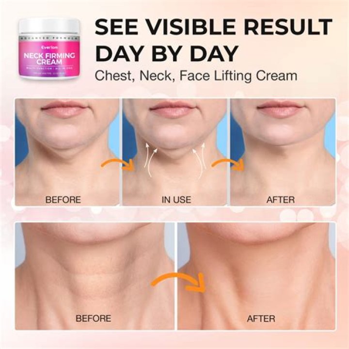 One Jar Of This Best-Selling Neck Tightening Cream Sells Every Minute & You Can Shop It For Under $100